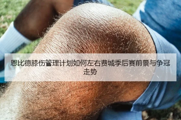 恩比德膝伤管理计划如何左右费城季后赛前景与争冠走势